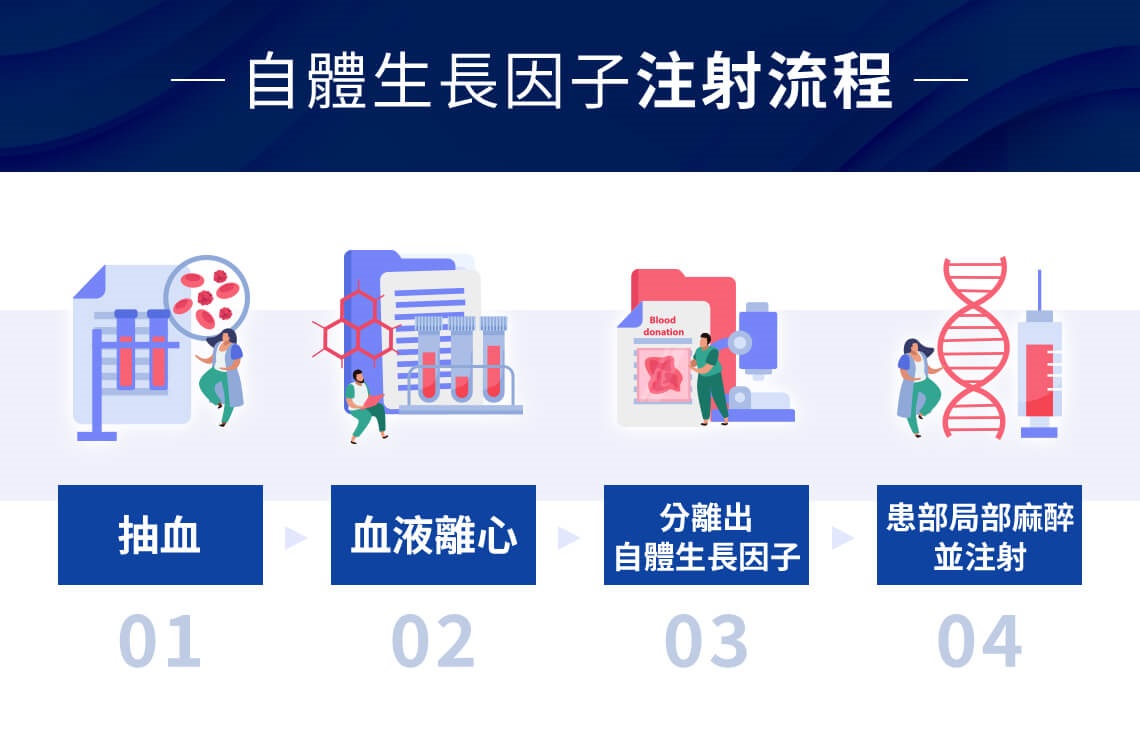 自體生長因子注射流程-掉髮改善推薦