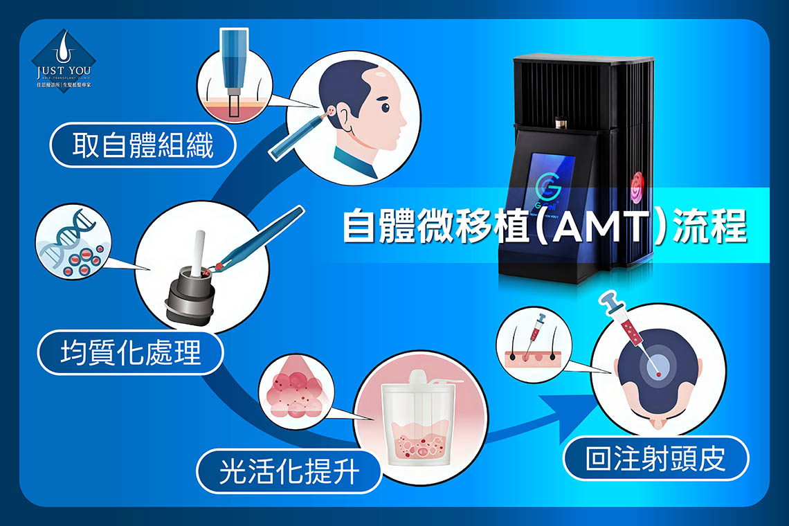 自體微移植(AMT)的醫學定義是什麼? 自體微移植(AMT),是指取用自身微小組織,經過製備後形成可回注的自體懸浮液,再導入需要修復或照護的部位。整個療程皆取材自體,不需使用異體細胞來源。