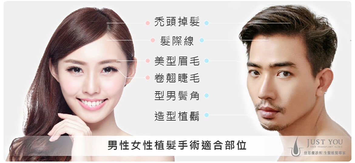 男女性植髮手術適合部位 男女性植髮手術適合部位-掉髮改善推薦