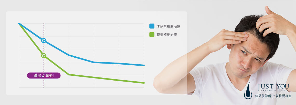如何挑選好的植髮診所-掉髮改善推薦